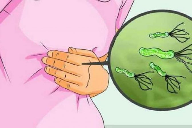Infectia cu Helicobacter pylori
